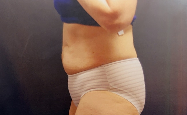 After Image