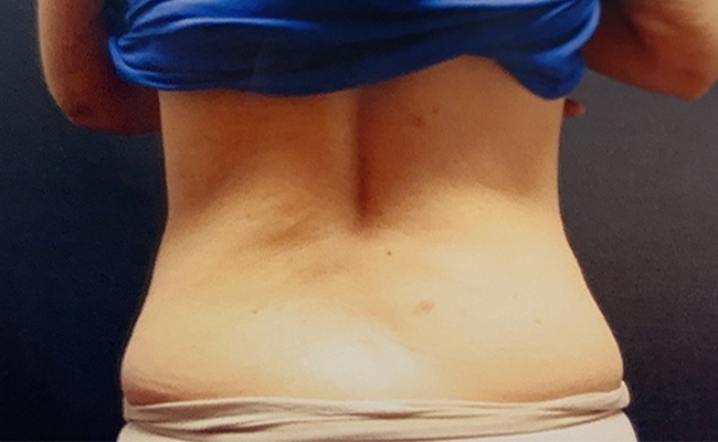 After Image