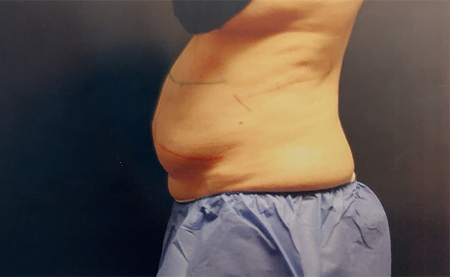 Before Image