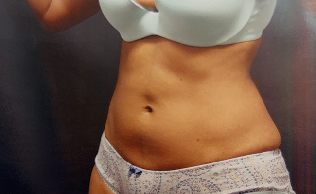 After Image